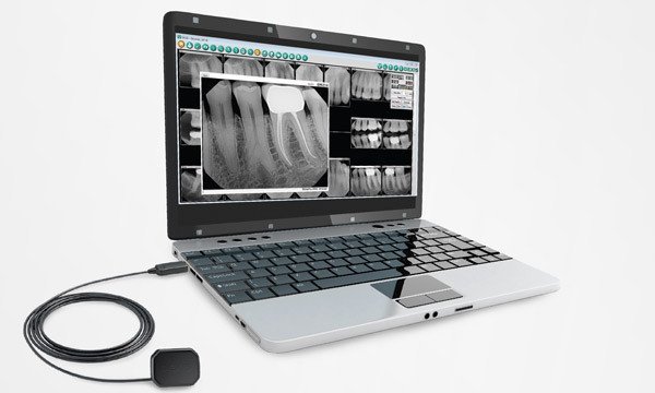 Laptop displaying dental X-rays with intraoral camera on white background.