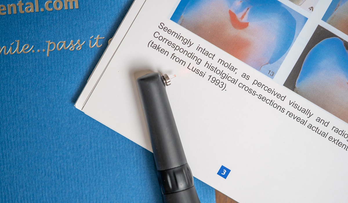 Dental document with pen on blue surface, showing molar cross-section imagery and clinical text.