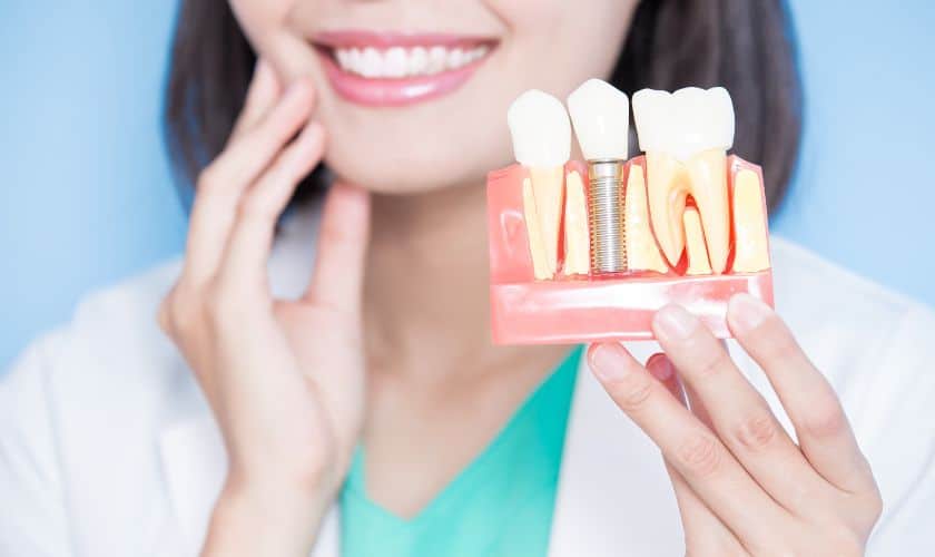 How Long Do Dental Implants Last?