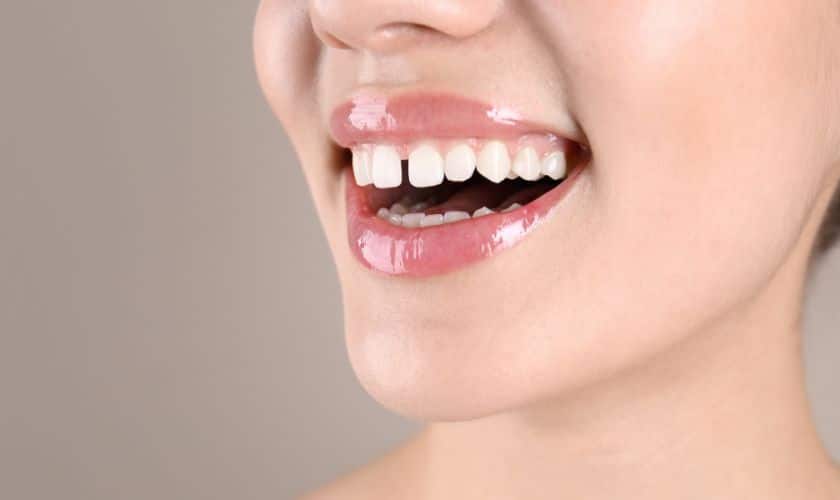 cosmetic Dentistry Can Close Gaps in Teeth