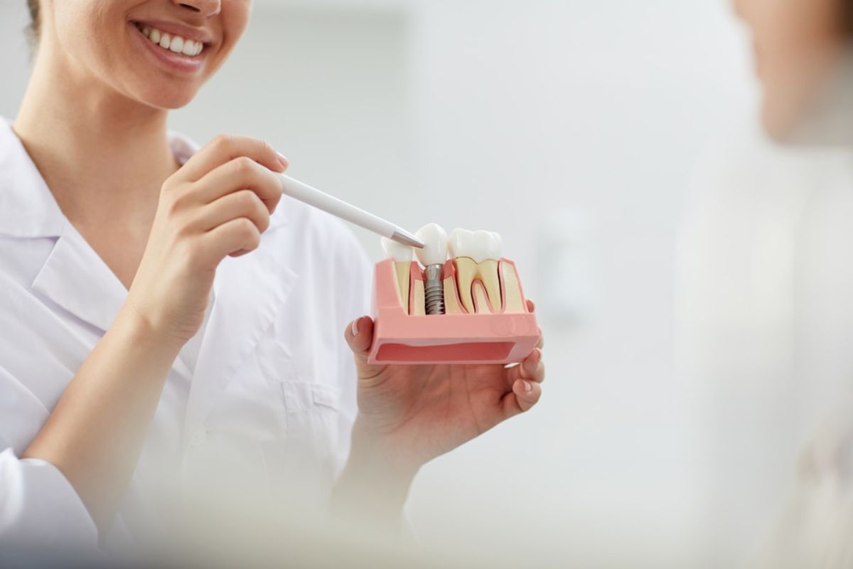 Dental Implant provider